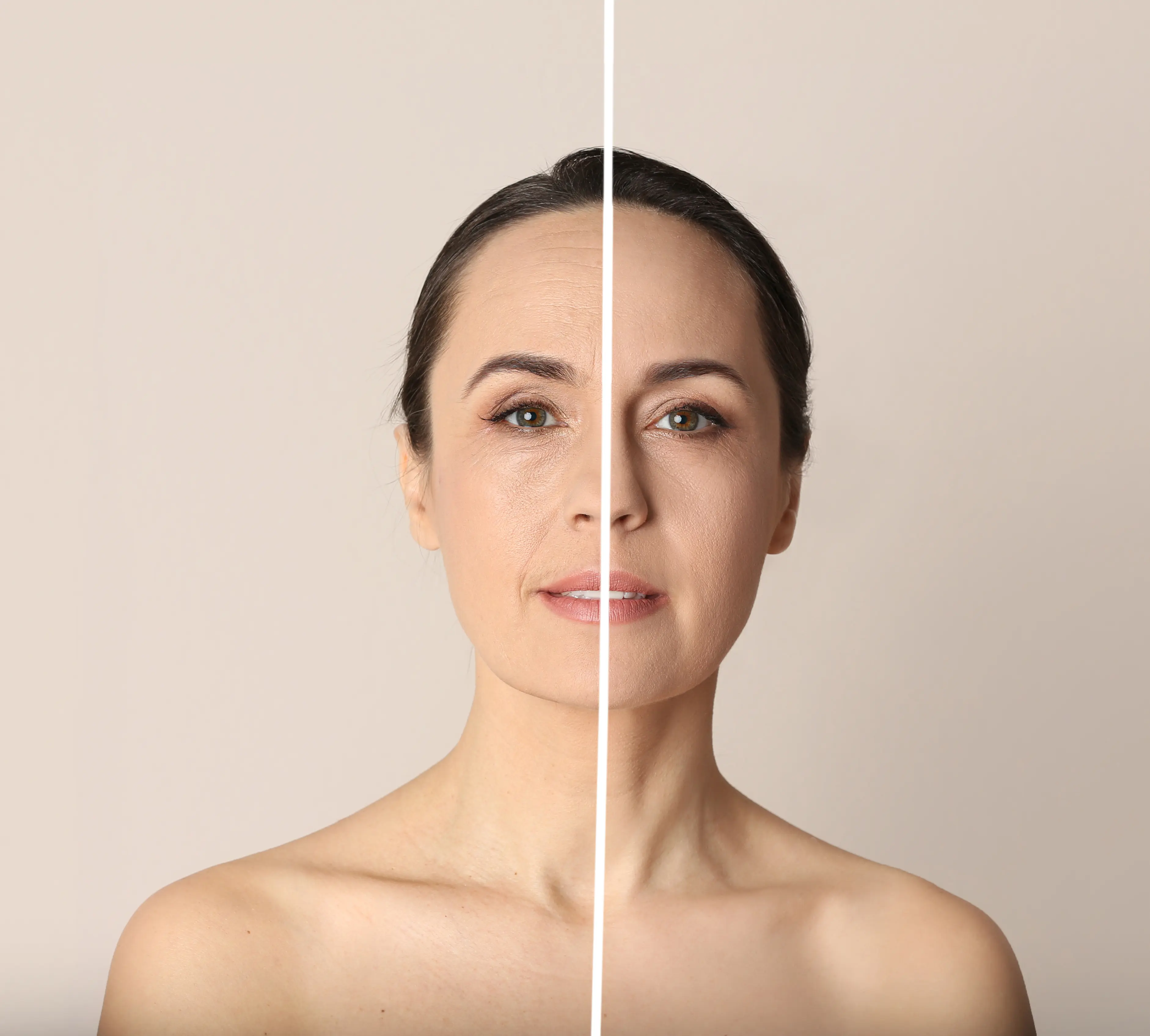 A woman's face is shown before and after a plastic surgery.