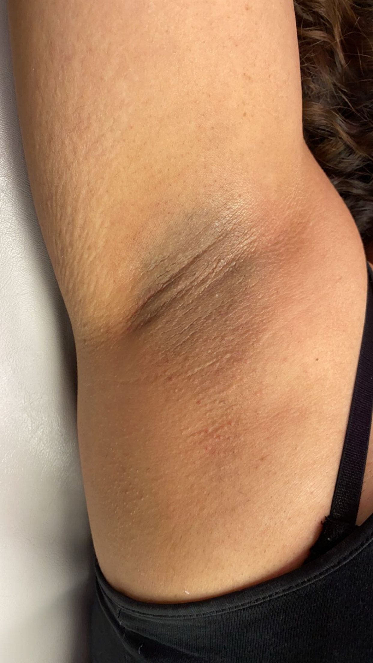 Armpit Wax After