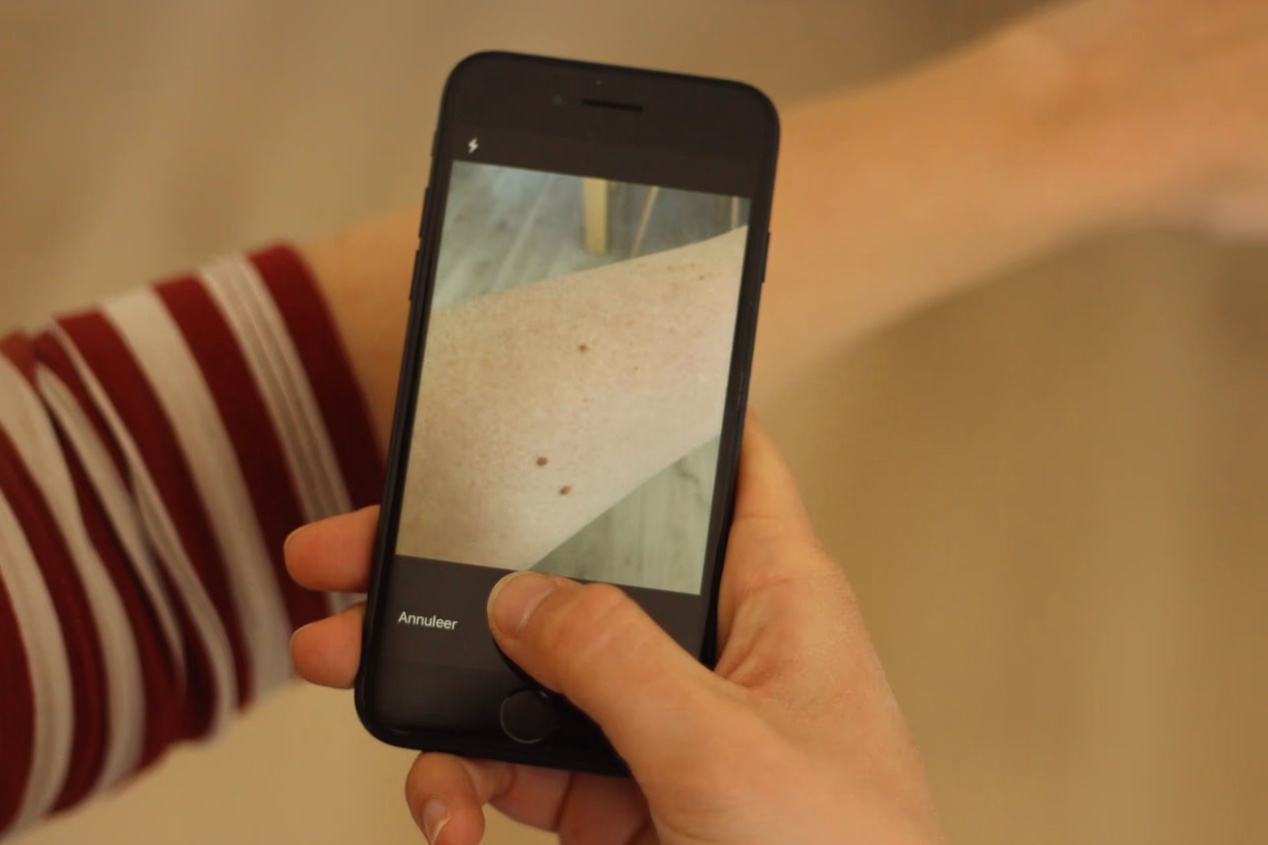 patient maakt foto van onderarm met moedervekken