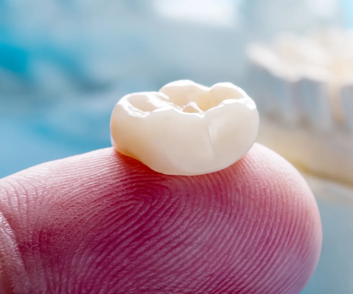 A dental crown resting on a person's fingertip, showing detailed tooth structure.