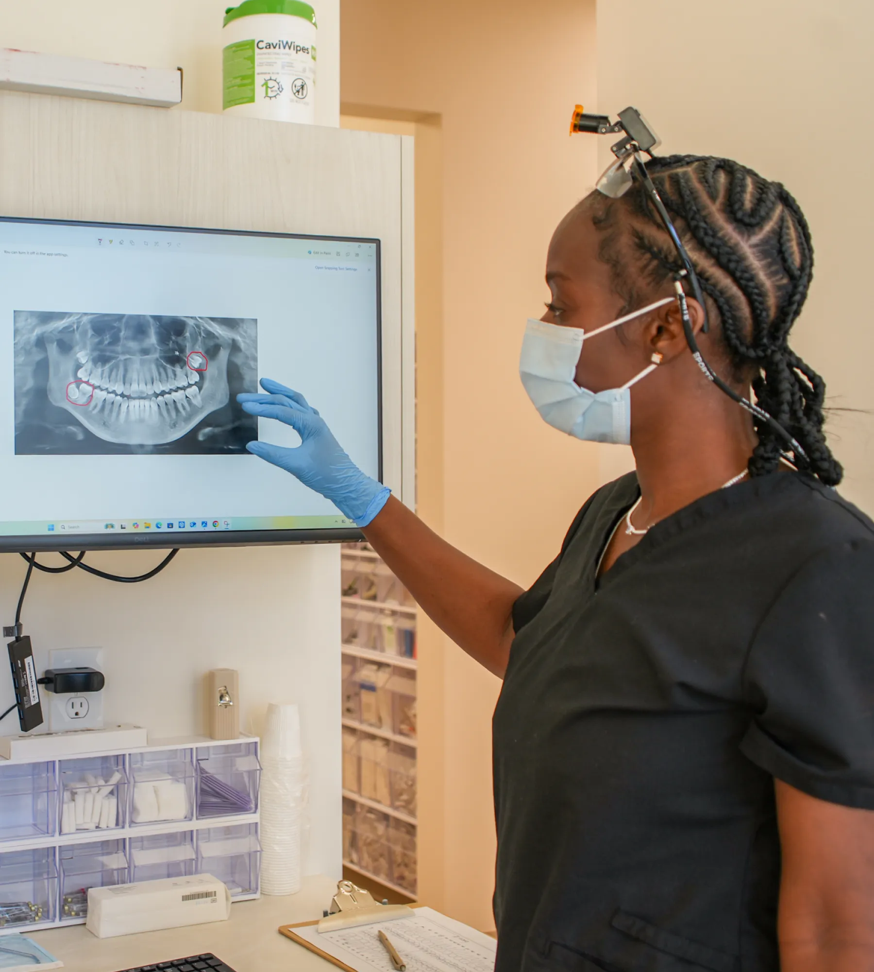 Kenner Dental Company team member showing x-ray image