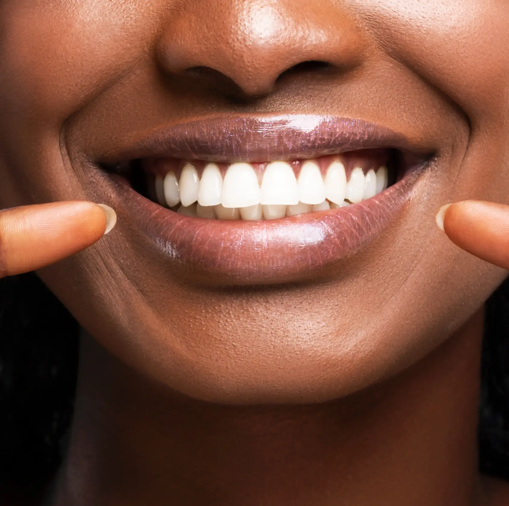 White smile