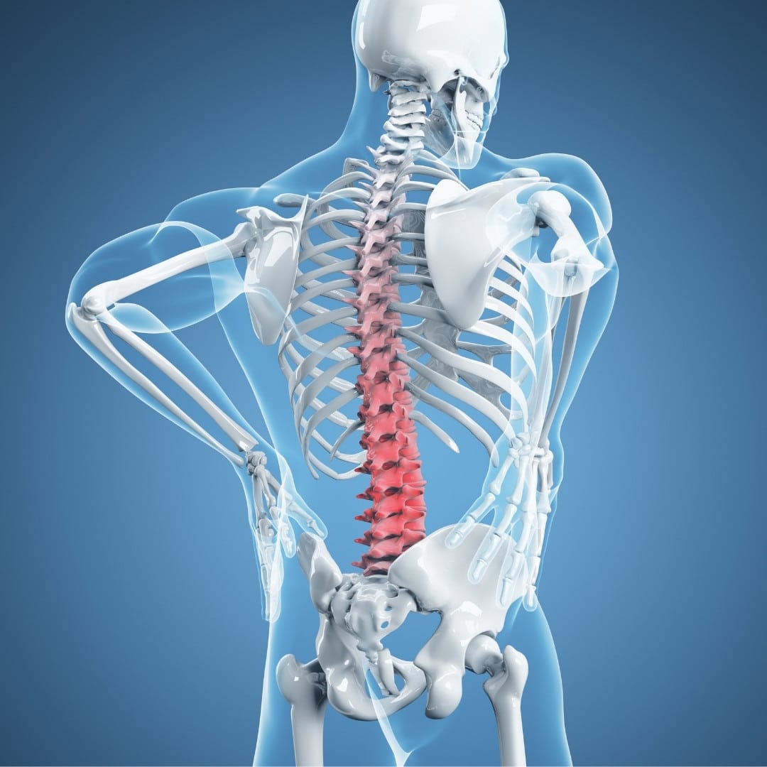 lumbar spondylosis icd 10