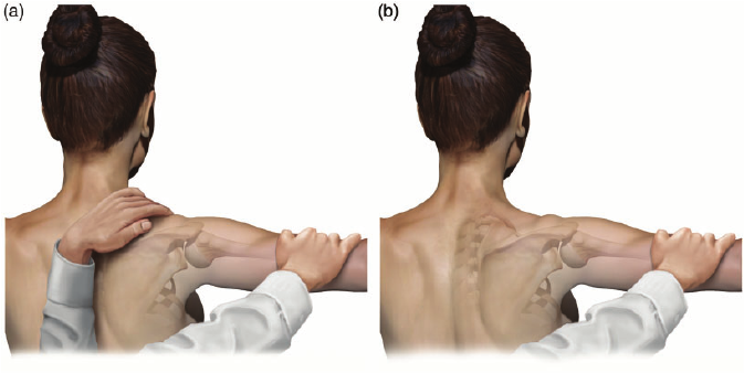 scapular retraction test