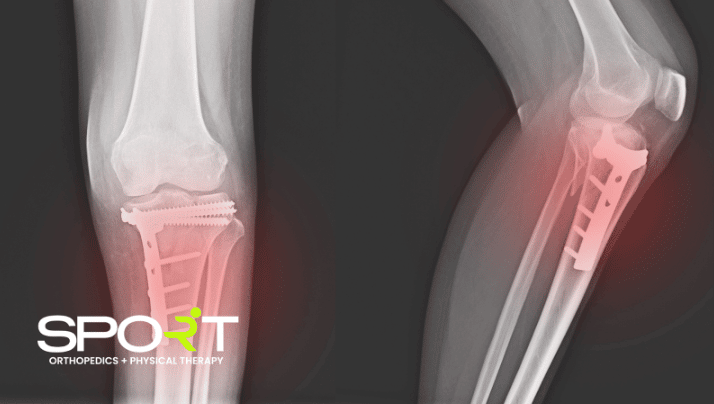 knee pain without injury