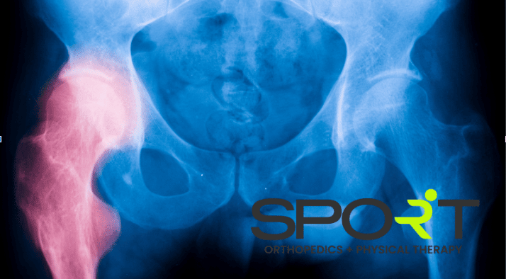 hip pain at night