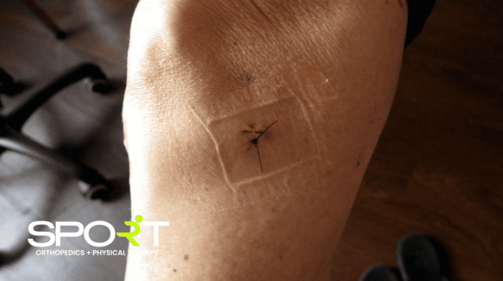 what can cause knee pain without injury