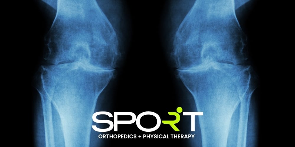 rheumatoid arthritis vs osteoarthritis