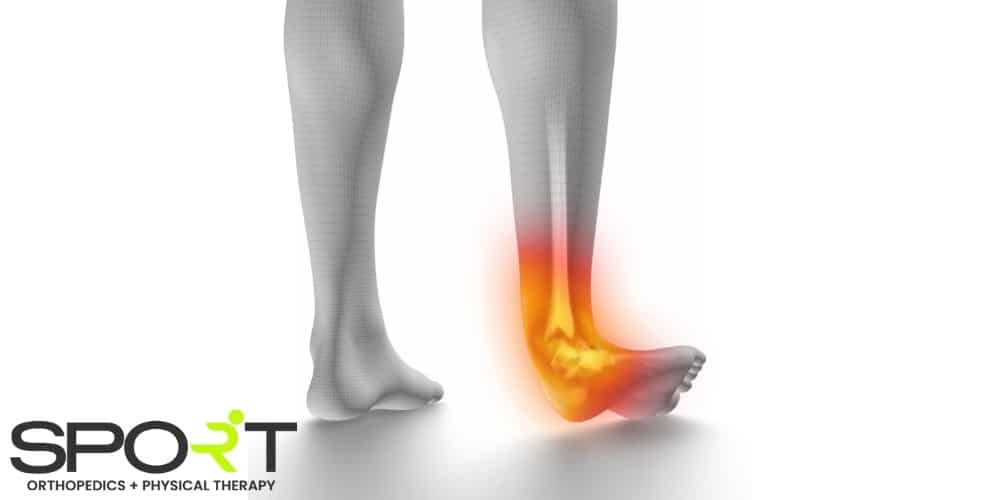 high vs low ankle sprain