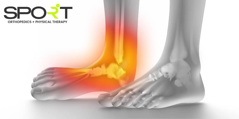 different types of ankle sprains