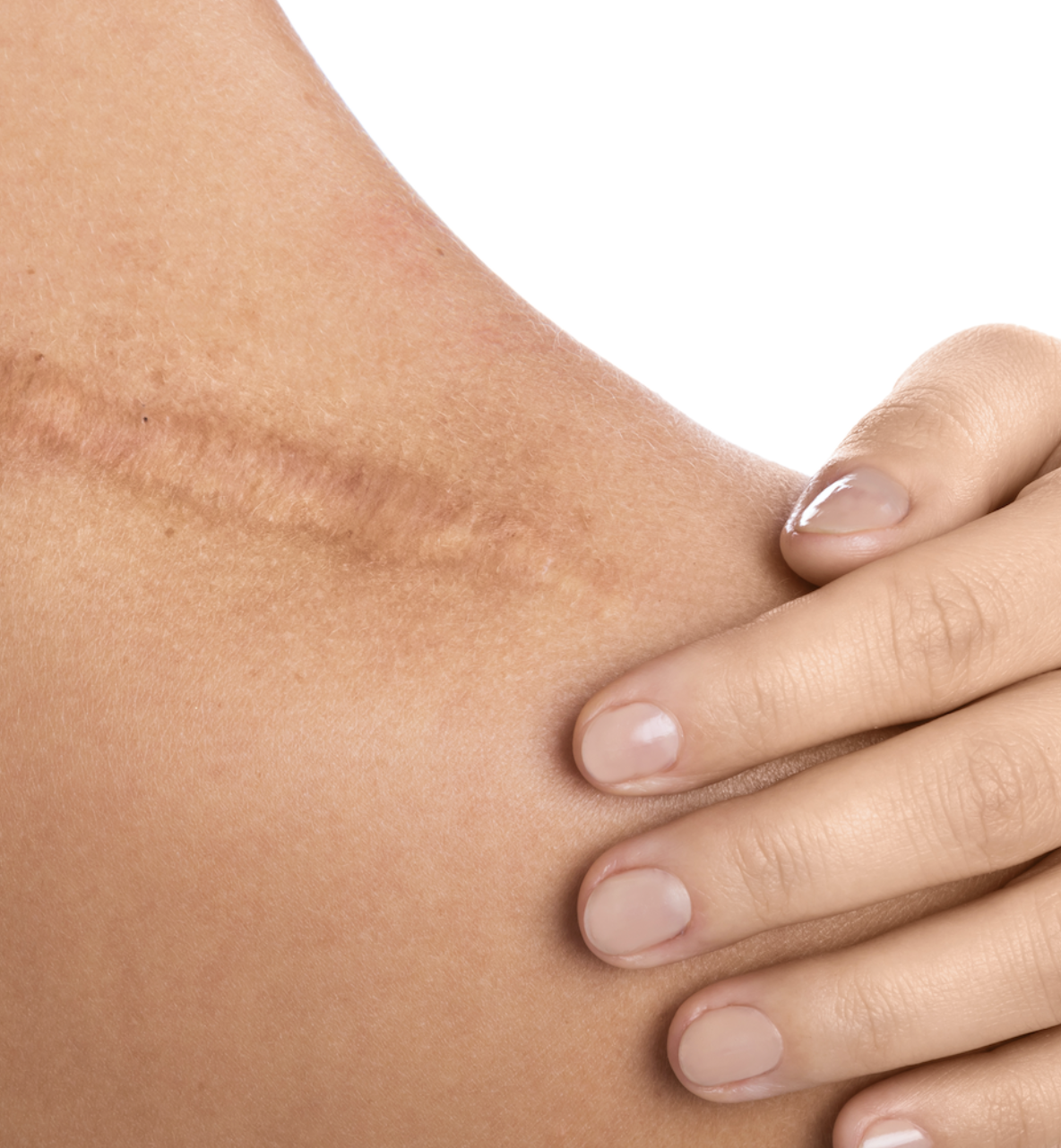 3 Myths About Scar Healing (And What Your Body Actually Needs)