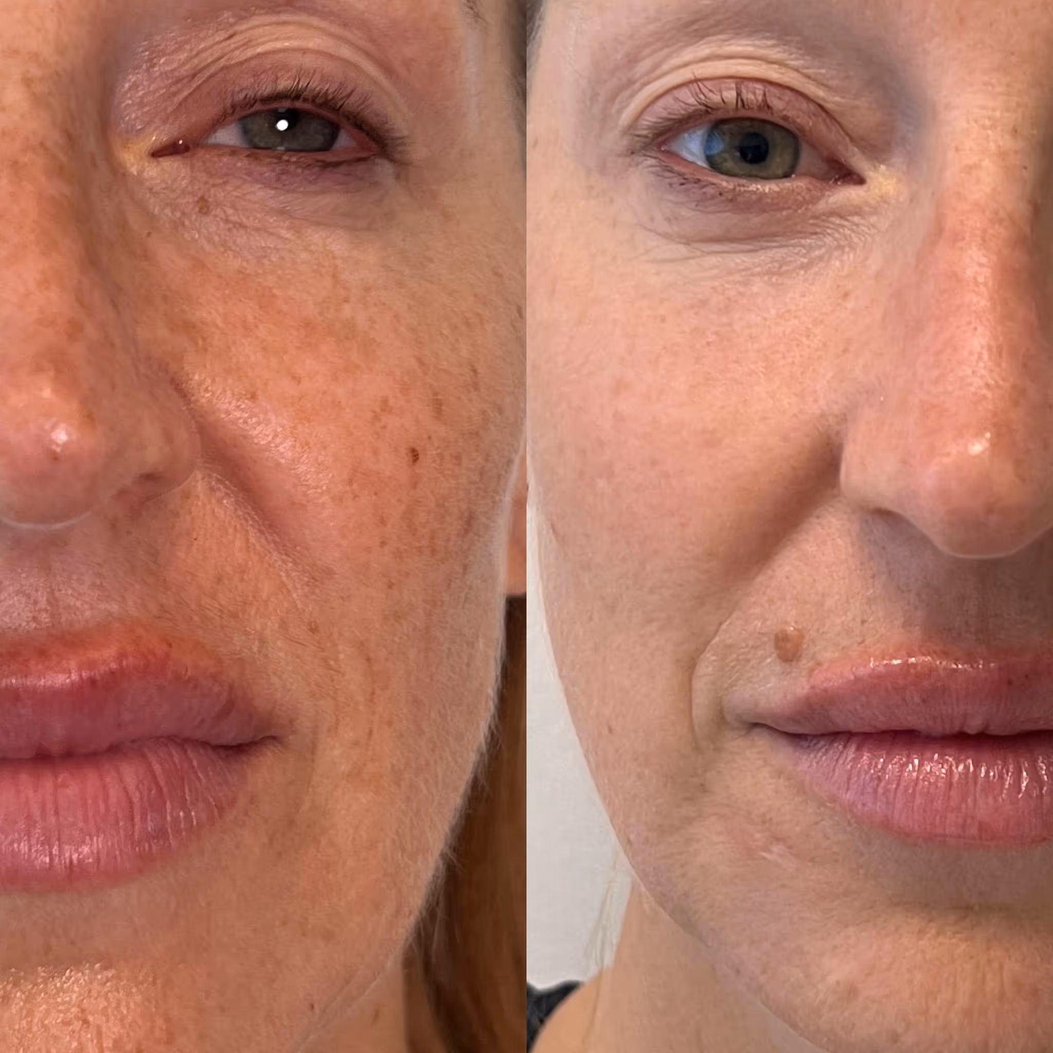 image of massage room (for a wellness center)