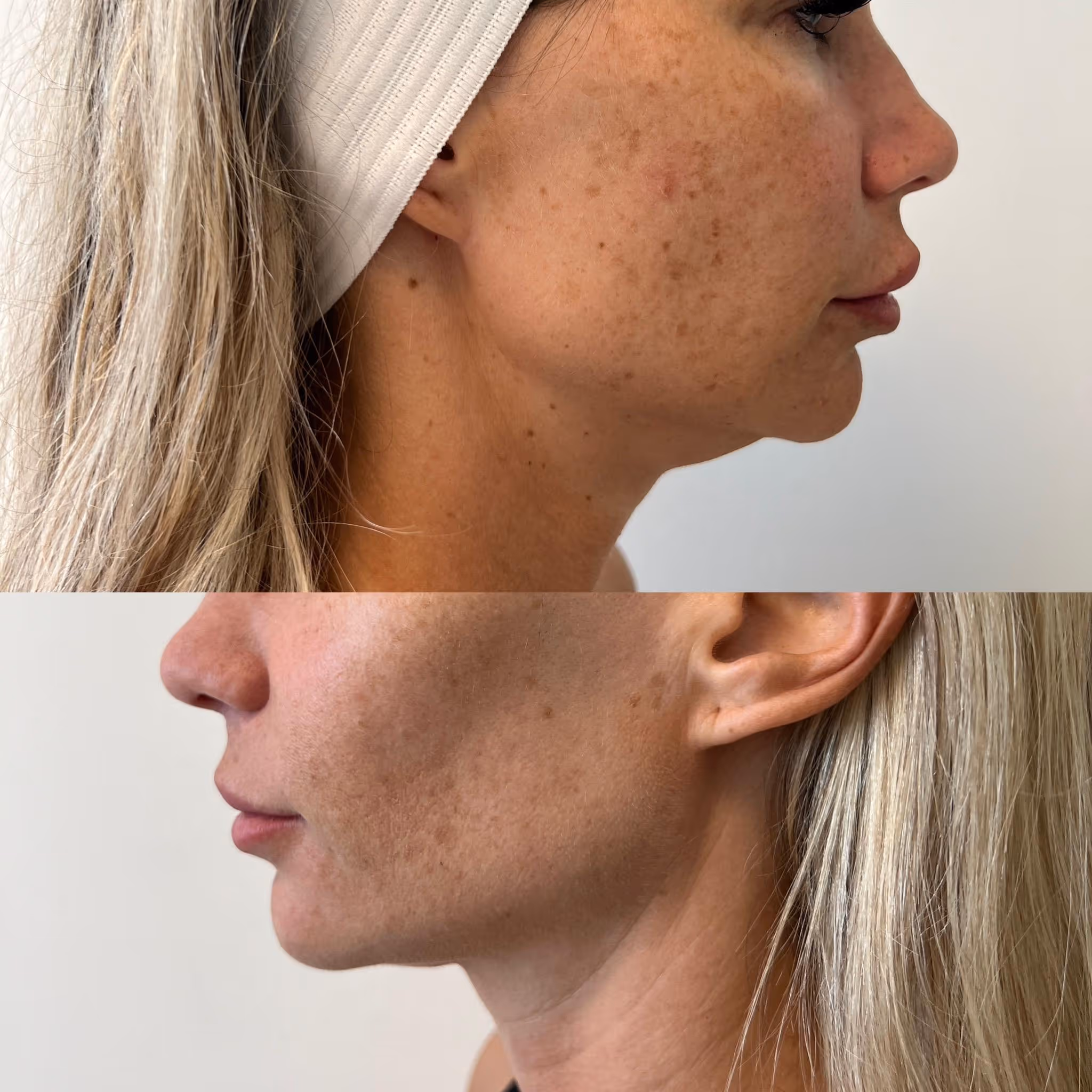 image of massage room (for a wellness center)