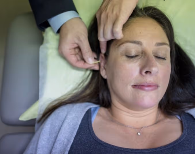 Personalised Acupuncture Session