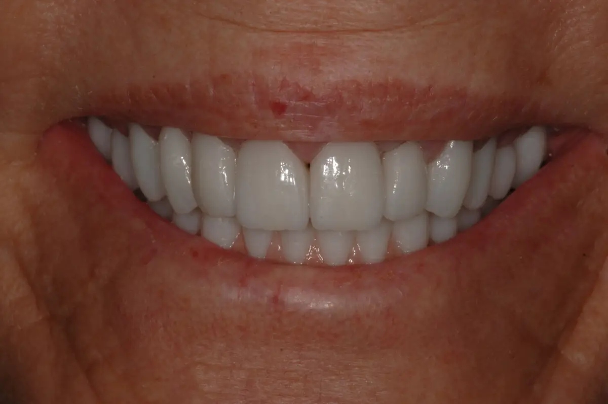 After Image