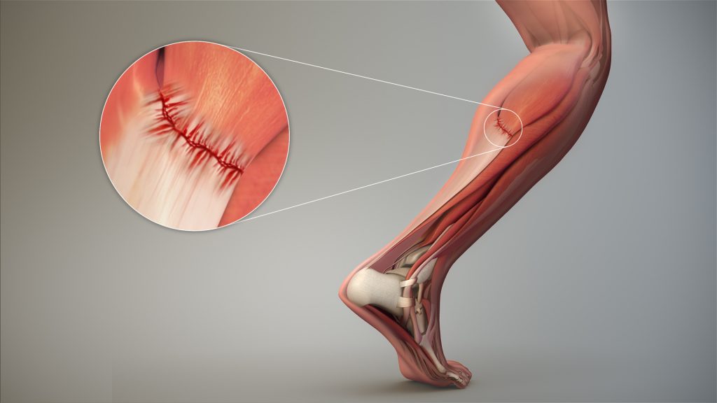 Portfolio Image