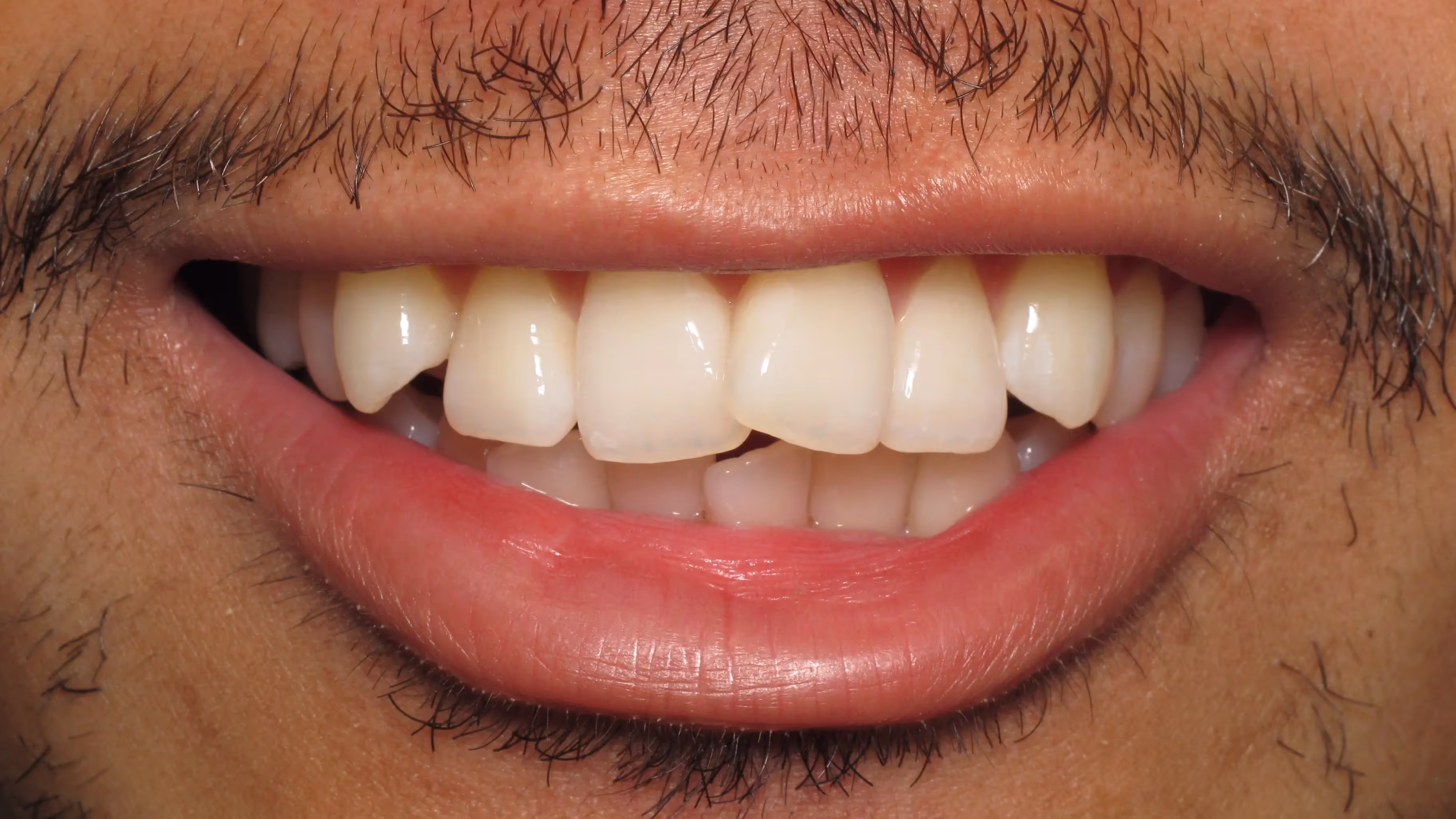 Before