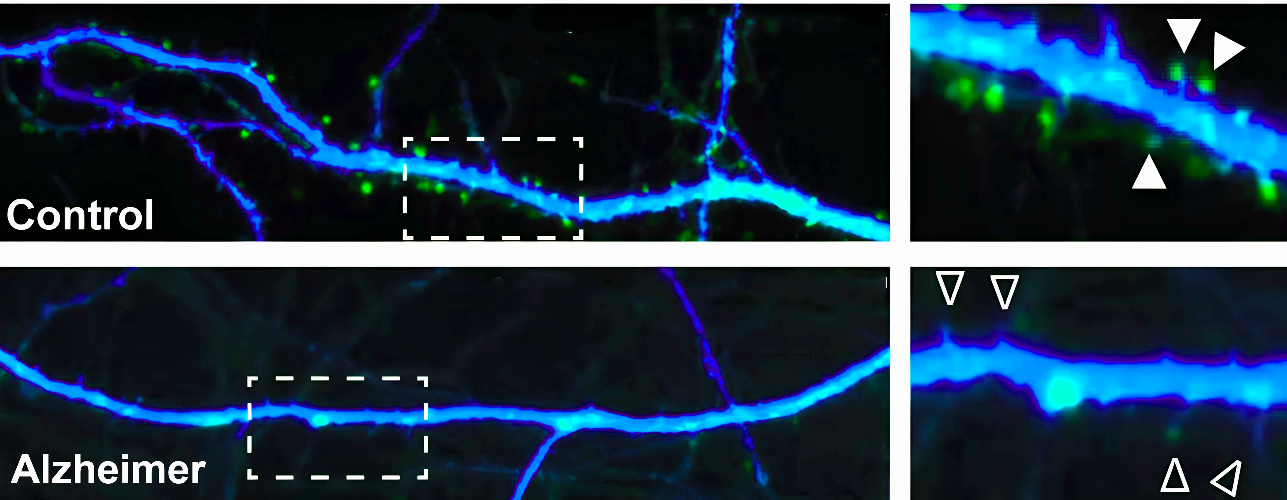 Scientific article image – Synapses - Alzheimer disease – Cellandart  