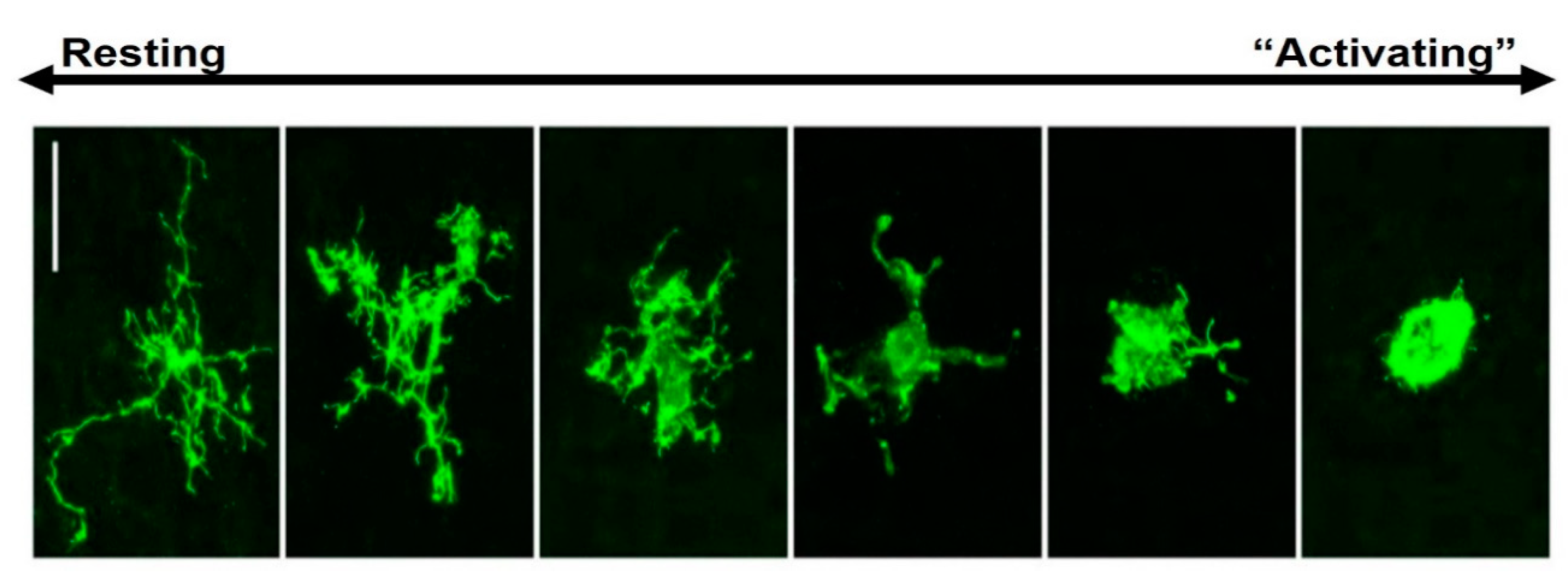 Scientific article image – La microglie – Cellandart 