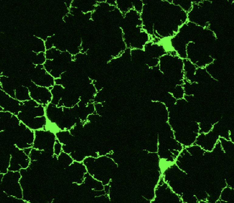 Scientific article image – La microglie – Cellandart 