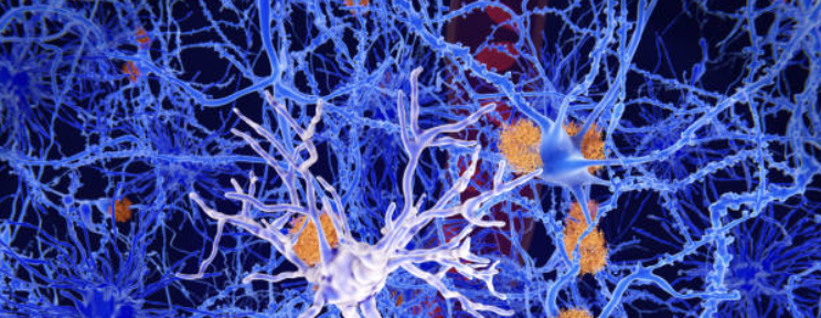 Scientific article image – La microglie – Cellandart 