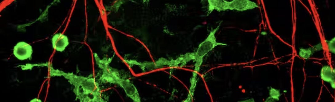 Scientific article image – La microglie – Cellandart 