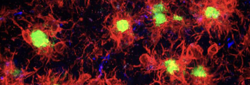 Scientific article image – La microglie – Cellandart 