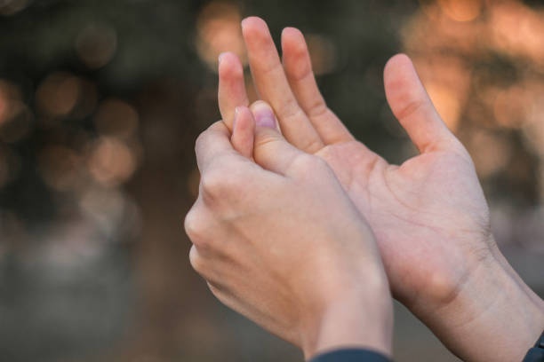 Hand of a person experiencing carpal tunnel pain.