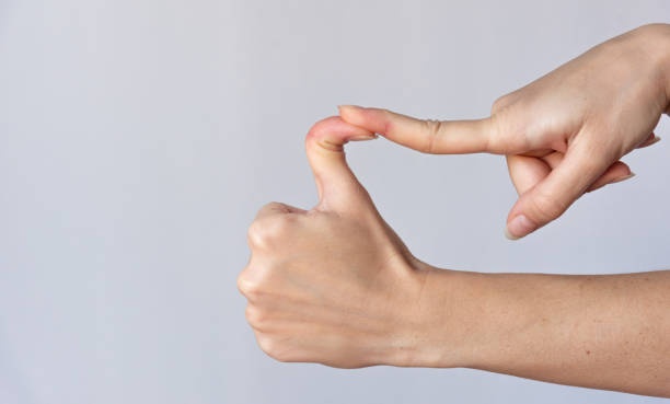 A person doing the finger extensor stretch to reduce trigger finger pain.