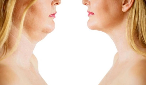 Face yoga before and after