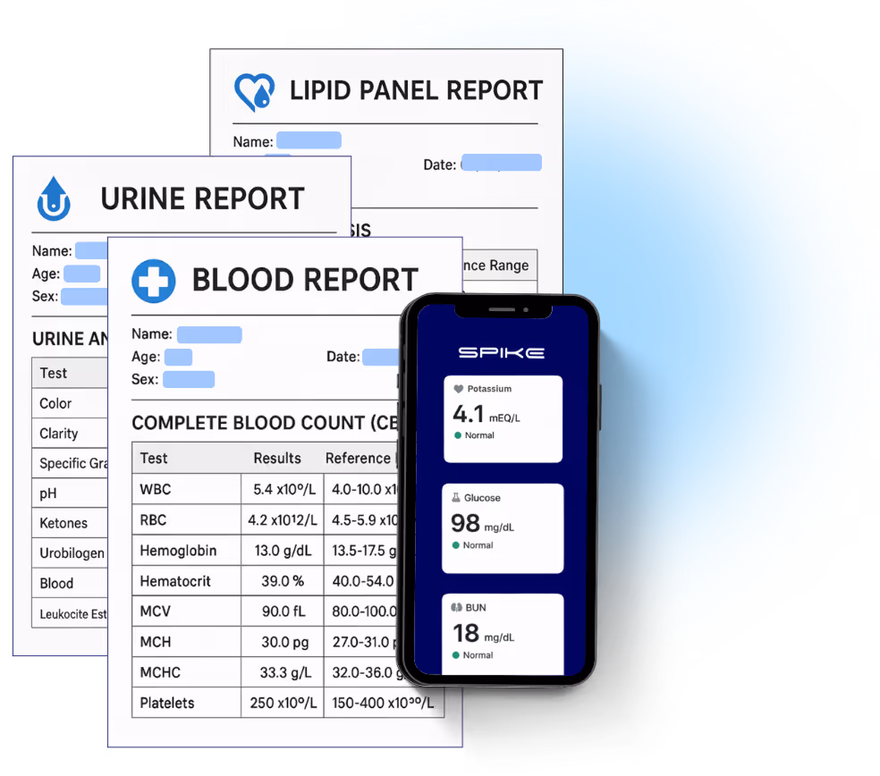 Smartphone displaying Spike app with potassium, glucose, and BUN levels, in front of printed blood, urine, and lipid panel reports.