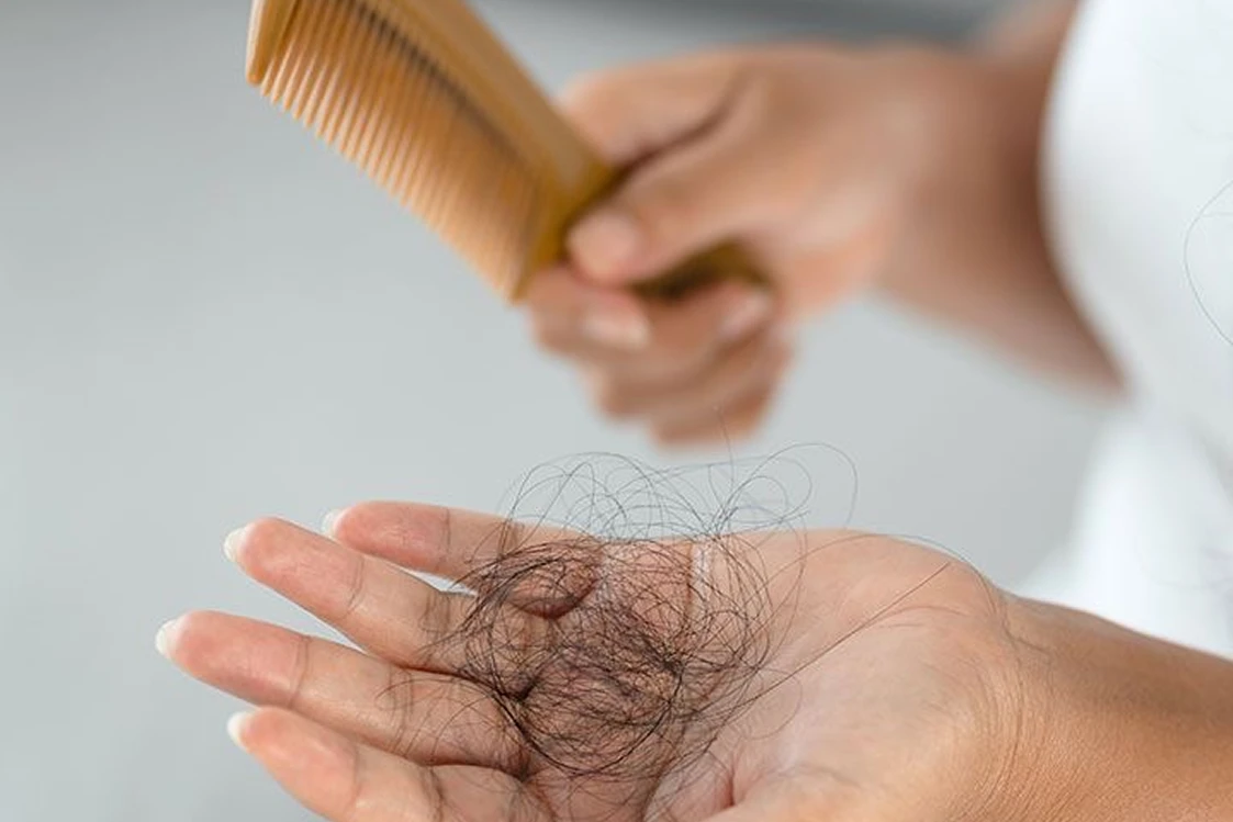 Caída del cabello tratada con Hair Booster en Alef Med Valencia