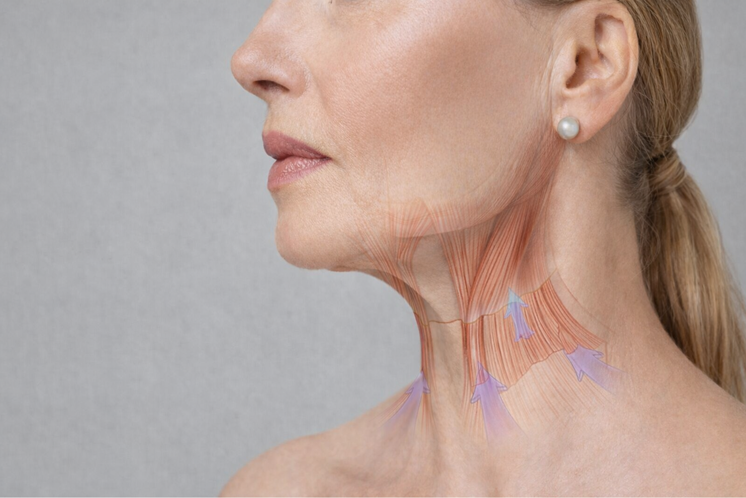 Hipertono muscular facial corregido con Bótox en Alef Med Valencia