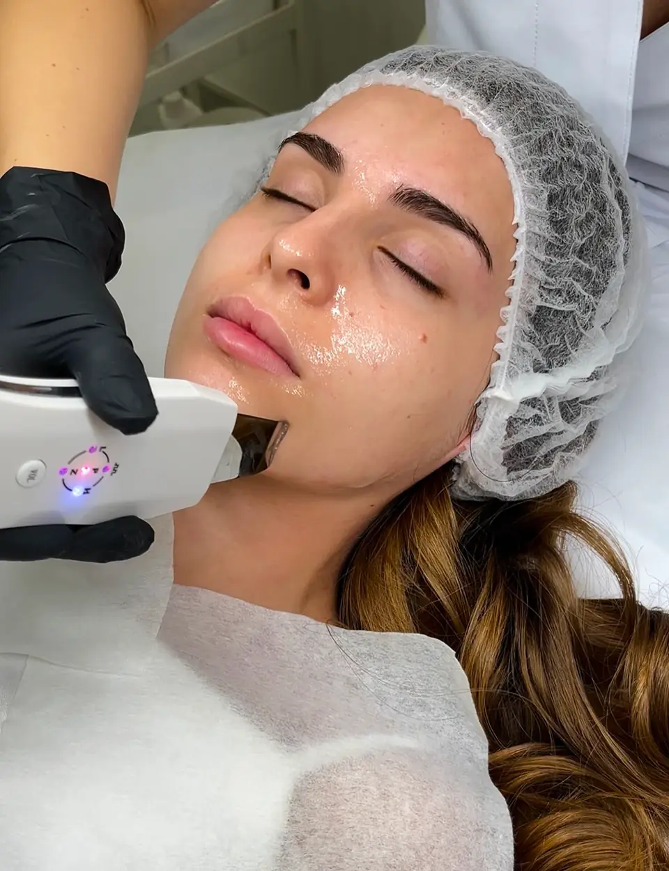 Limpieza facial combinada profunda en clínica Alef Med Valencia