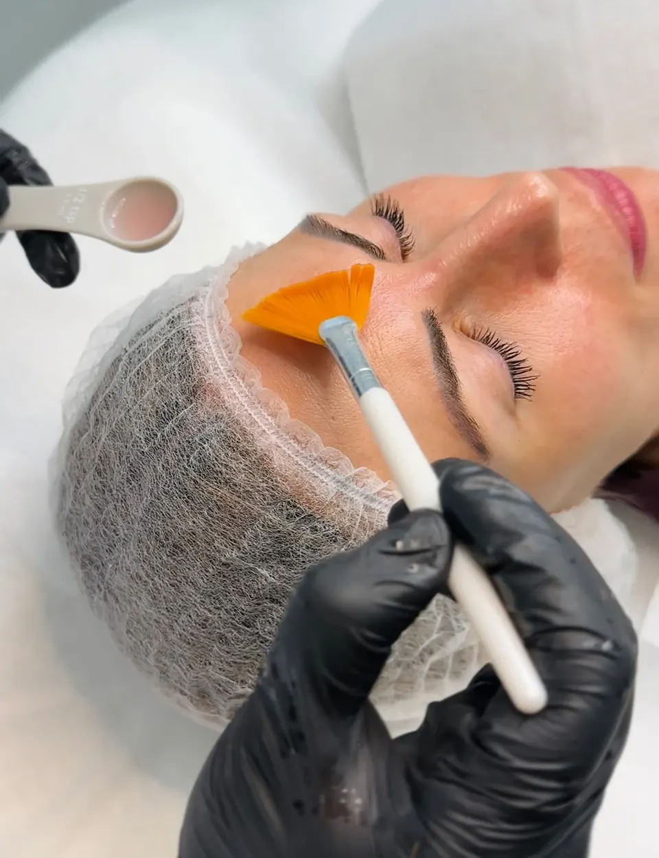 Cleopatra Peel by Hikari — aesthetic treatment at Alef Med clinic in Valencia