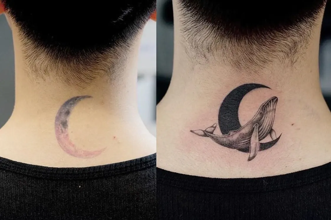 Tatuaje no deseado antes de eliminación láser en Alef Med Valencia