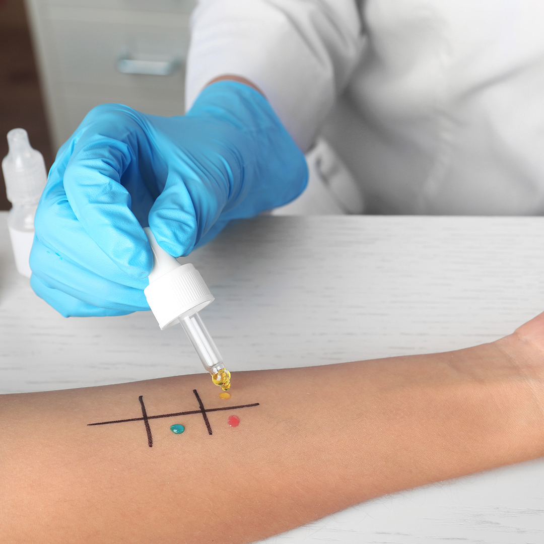 alergia alimentaria llagas exámenes