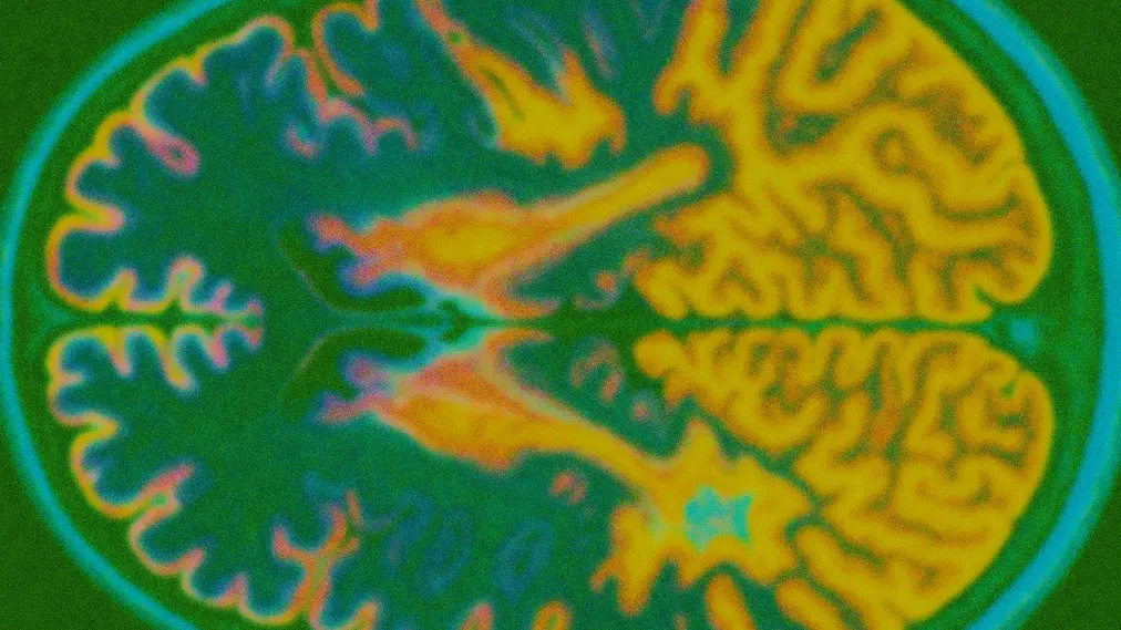 A close up of a colorful brain scan.