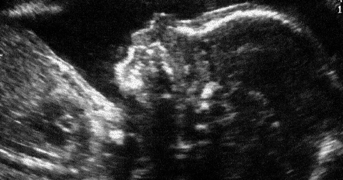 Calls for national conversation as UK abortion numbers hit record high