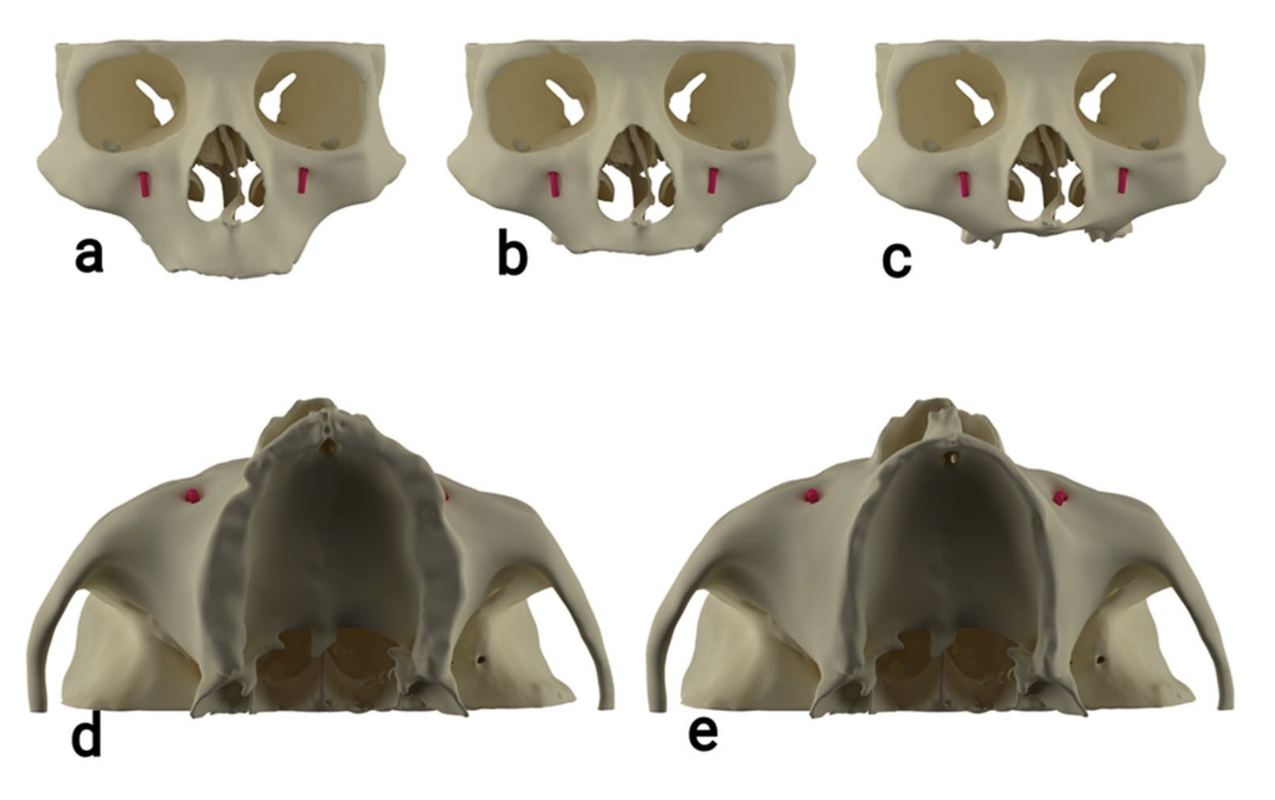 Z-Classification