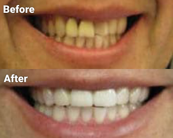 Before & After image