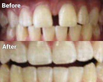 Before & After image