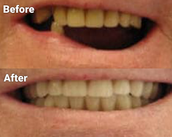 Before & After image