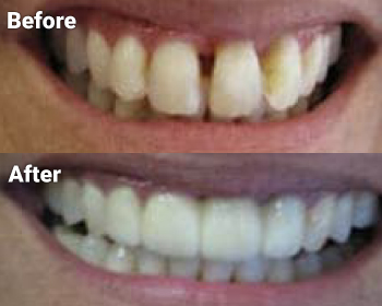 Before & After image