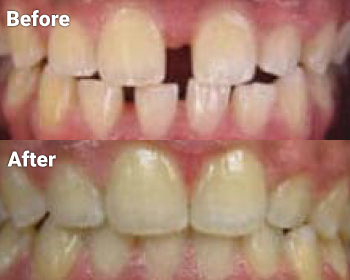 Before & After image