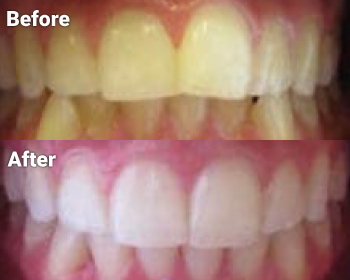 Before & After image