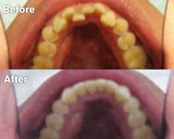Before & After image