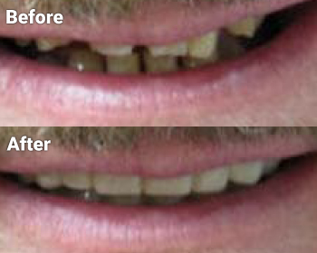 Before & After image