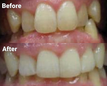 Before & After image