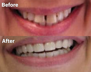Before & After image